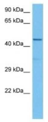 Western Blot: APOBEC3B Antibody [NBP3-10834]