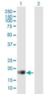 Western Blot: APOBEC3C Antibody [H00027350-B01P]