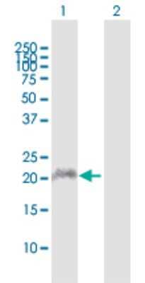 Western Blot: APOBEC3C Antibody [H00027350-D01P]