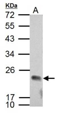 Western Blot: APOBEC3C Antibody [NBP2-14875]