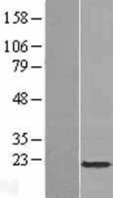 Western Blot: APOBEC3C Overexpression Lysate [NBP2-07320]