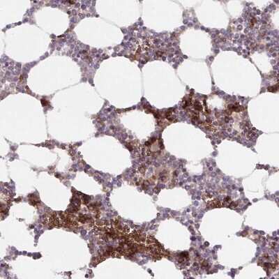 Immunohistochemistry: APOBEC3D Antibody [NBP2-49168]