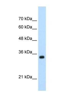 Western Blot: APOBEC3D Antibody [NBP1-57440]