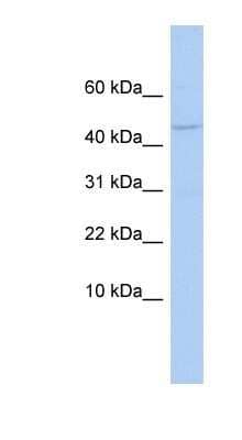 Western Blot: APOBEC3F Antibody [NBP1-57513]