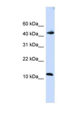 Western Blot: APOBEC3F Antibody [NBP1-57515]