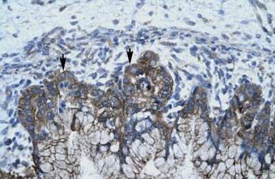 Immunohistochemistry: APOBEC3G Antibody [NBP1-58955]