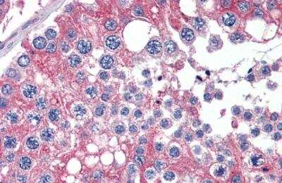 Immunohistochemistry-Paraffin: APOBEC3G Antibody [NBP1-05026]