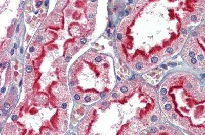 Immunohistochemistry-Paraffin: APOBEC3G Antibody [NBP1-05026]