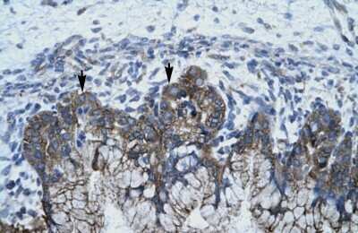 Immunohistochemistry-Paraffin: APOBEC3G Antibody [NBP1-58955]
