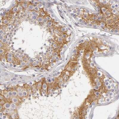 Immunohistochemistry-Paraffin: APOBEC3G Antibody [NBP1-88592]