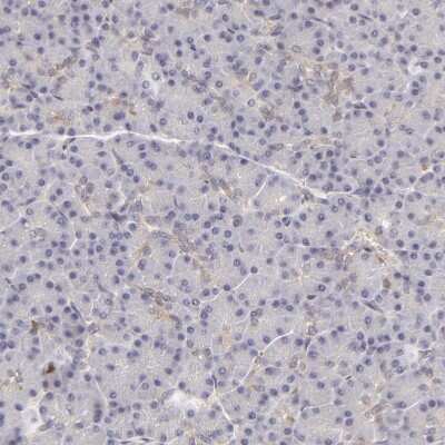 Immunohistochemistry-Paraffin: APOBEC3G Antibody [NBP1-88592]
