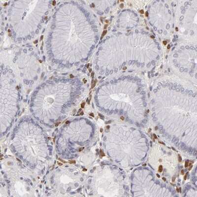 Immunohistochemistry-Paraffin: APOBEC3G Antibody [NBP1-88592]