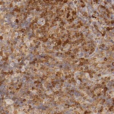 Immunohistochemistry-Paraffin: APOBEC3G Antibody [NBP1-88592]