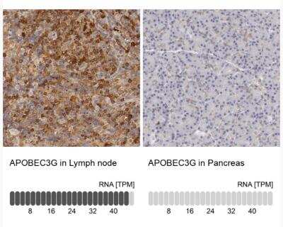 Immunohistochemistry-Paraffin: APOBEC3G Antibody [NBP1-88592]