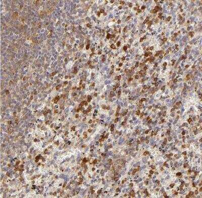 Immunohistochemistry-Paraffin: APOBEC3G Antibody [NBP1-88592]