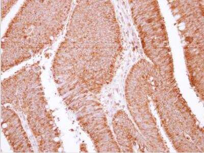 Immunohistochemistry-Paraffin: APOBEC3G Antibody [NBP2-53089]