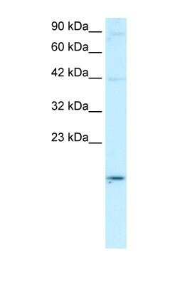 Western Blot: APOBEC3G Antibody [NBP1-58955]