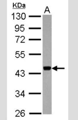 Western Blot: APOBEC3G Antibody [NBP2-53089]