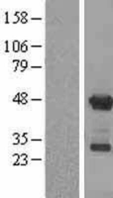 Western Blot: APOBEC3G Overexpression Lysate [NBL1-07615]