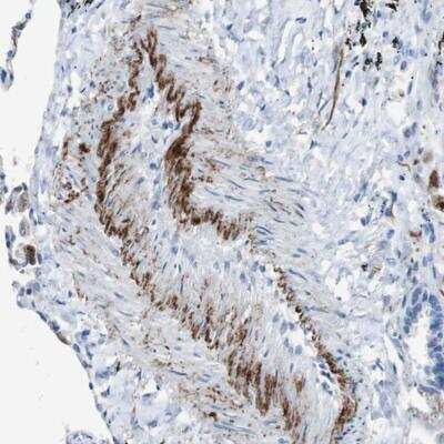 Immunohistochemistry: APOBEC4 Antibody [NBP1-88490]