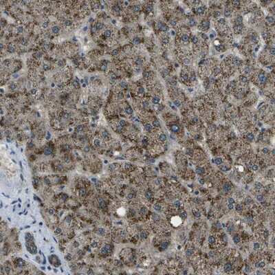 Immunohistochemistry-Paraffin: APOBEC4 Antibody [NBP1-88491]