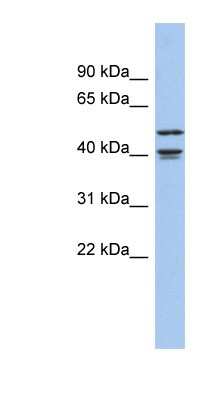 Western Blot: APOBEC4 Antibody [NBP1-56377]