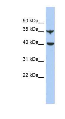 Western Blot: APOBEC4 Antibody [NBP1-56380]