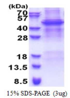 SDS-PAGE: Recombinant Human APOBEC4 His Protein [NBP2-22690]