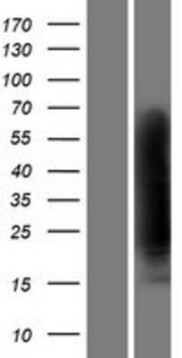 Western Blot: Clusterin/APOJ Overexpression Lysate [NBP2-04577]