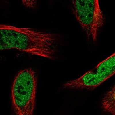 Immunocytochemistry/ Immunofluorescence: APOL6 Antibody [NBP1-89031]