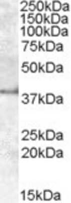 Western Blot: APOL6 Antibody [NBP1-36935]