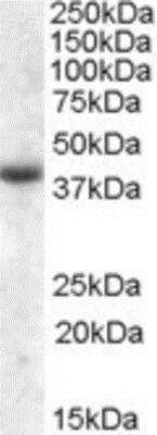 Western Blot: APOL6 Antibody [NBP1-51929]