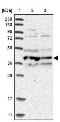 Western Blot: APOL6 Antibody [NBP1-89032]