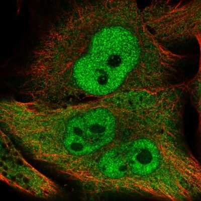 Immunocytochemistry/ Immunofluorescence: APOLD1 Antibody [NBP2-49046]