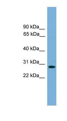 Western Blot: APOLD1 Antibody [NBP1-79330]