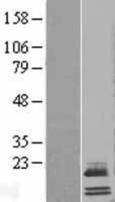 Western Blot: APOO Overexpression Lysate [NBL1-07630]