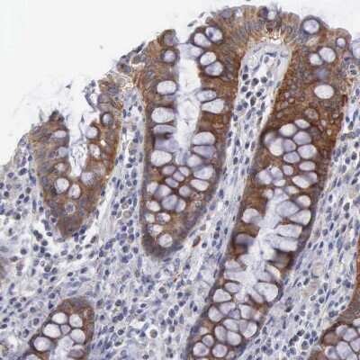 Immunohistochemistry-Paraffin: APOOL Antibody [NBP1-89325]