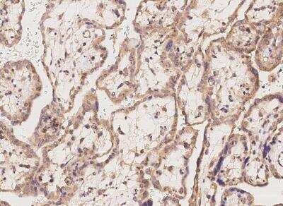 Immunohistochemistry-Paraffin: APOOL Antibody [NBP3-05931]