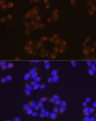 Immunocytochemistry/ Immunofluorescence: APP Antibody (3A8S2) [NBP3-15560]