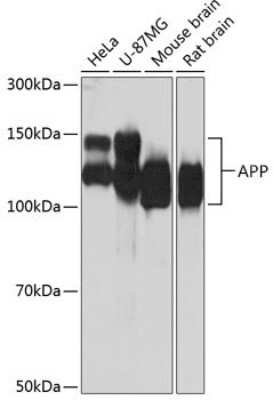 Western Blot: APP Antibody (3A8S2) [NBP3-15560]