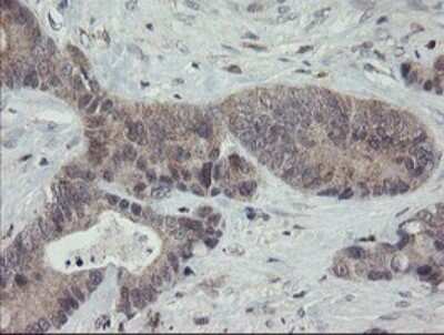 Immunohistochemistry: APP Antibody (OTI4C9) [NBP2-46535]