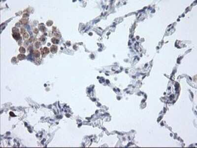 Immunohistochemistry: APP Antibody (OTI4C9) [NBP2-46535]