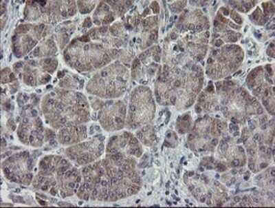 Immunohistochemistry: APP Antibody (OTI4C9) [NBP2-46535]