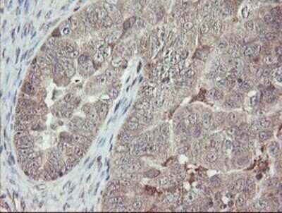 Immunohistochemistry: APP Antibody (OTI4C9) [NBP2-46535]