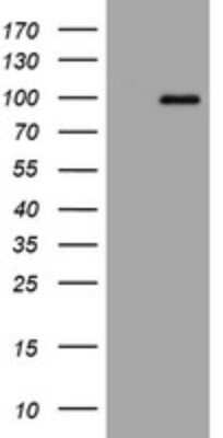 Western Blot: APP Antibody (OTI4C9) [NBP2-46535]