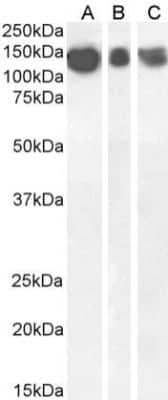 Western Blot: APP Antibody (6E10)ChimericAzide and BSA Free [NBP2-62566]