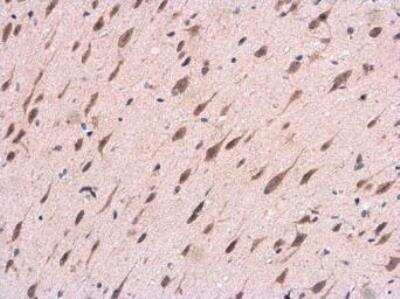Immunohistochemistry-Paraffin: APP Antibody [NBP1-32081]