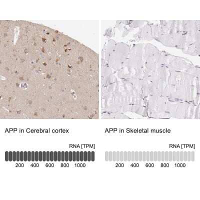 Immunohistochemistry-Paraffin: APP Antibody [NBP1-90246]