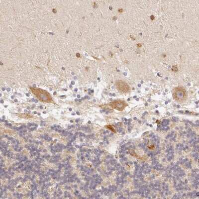 Immunohistochemistry-Paraffin: APP Antibody [NBP1-90246]