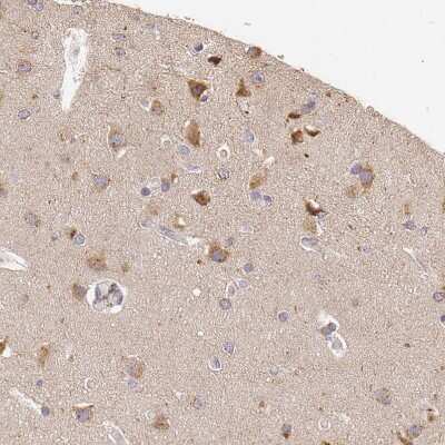 Immunohistochemistry-Paraffin: APP Antibody [NBP1-90246]